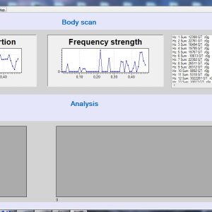 Sirius-biofeedback-software-frequenties