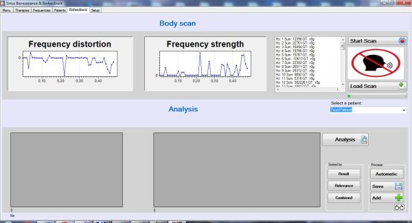 Sirius-biofeedback-software-frequenties